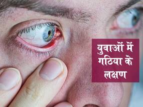 आंखों में भी दिखते हैं गठिया के लक्षण, जानें युवाओं में इसे पहचानने के 5 शुरुआती संकेत