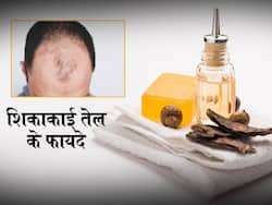 पुरुषों में गंजेपन का उपचार का शिकाकाई तेल, जानें इसे बनाने की विधि, लगाने का तरीका और 4 फायदे