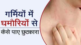 Summer Skin Allergies: गर्मियों में स्किन पर दिख रहें ये लक्षण, तो हो जाएं सावधान, Watch Video