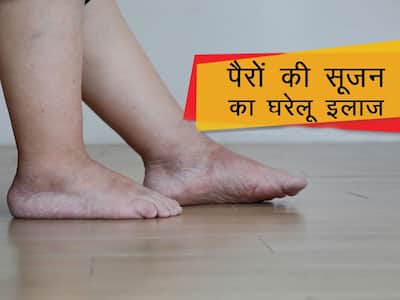 Swelling in Legs | Home Remedies For Swollen Legs In Hindi | पैरों की