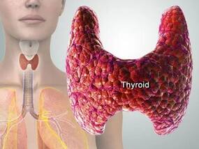 Elevated Blood Cholesterol Level To Constipation: 3 Signs of An Overactive Thyroid
