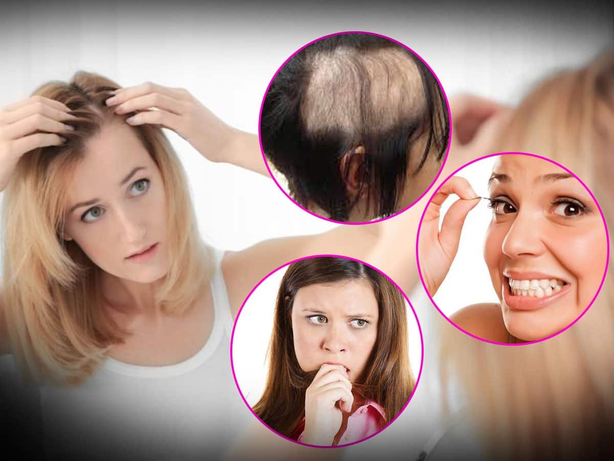 Trichotillomania A Closer Look at this HairPulling Disorder  AHS UAE