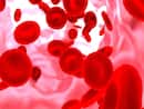 International Thalassaemia Day 2022: What Tests Are Done For Diagnosis Of This Blood Disorder?