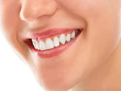 Natural Home Remedies For Teeth Whitening