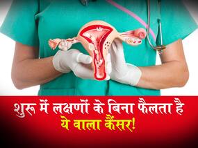 महिलाओं में Ovarian Cancer का सबसे आम रूप है ये वाला कैंसर, 90 फीसदी से ज्यादा महिलाएं होती हैं इसका शिकार