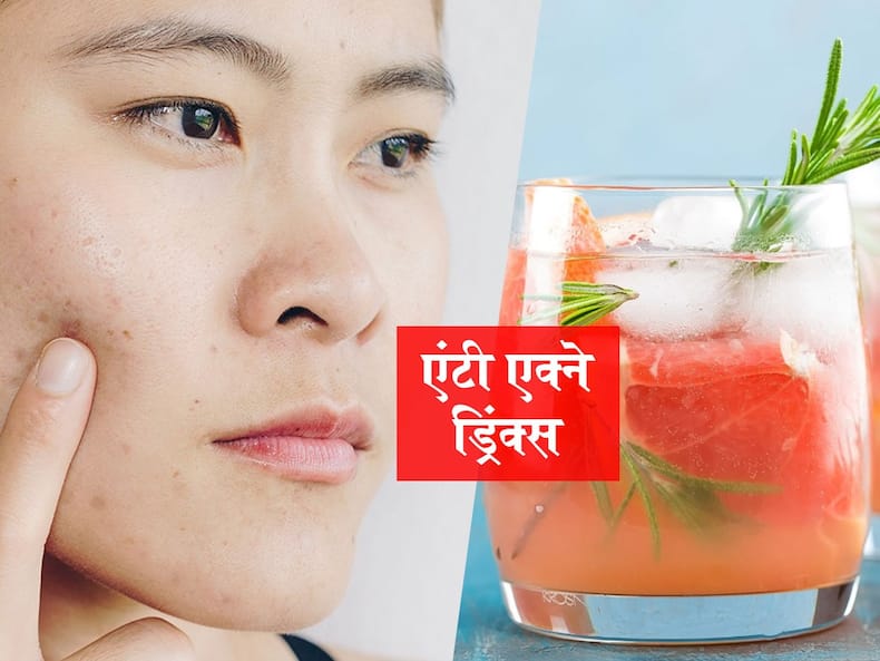 लस्सी, छाछ और स्मूदी बढ़ा सकते हैं एक्ने और पिंपल्स, तो आज से पिएं ये 5 एंटी एक्ने ड्रिंक्स