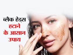 टूथपेस्ट और बेकिंग सोडा जैसी इन 5 चीजों से हटाएं ब्लैक हेड्स, जानें इस्तेमाल का तरीका