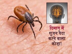 Powassan virus in hindi : इस कीड़े के काटने पर दिमाग में होने लगती है सूजन! महसूस हो ये 4 लक्षण तो न करें नजरअंदाज