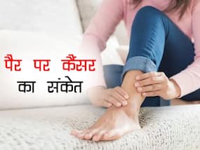 पैर पर दिखते हैं इस कैंसर के सबसे पहले संकेत! जानें किस संकेत से आप पता लगा सकते हैं कैंसर