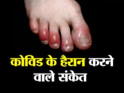 शरीर में दिखाई देने वाले ये 4 बदलाव हैं कोविड होने का संकेत, बुखार-खांसी नहीं जानकर चौंक जाएंगे