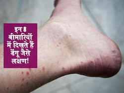 इन 8 बीमारियों की ही तरह दिखते हैं डेंगू के लक्षण, इन 2 टेक्निक से लगाया जाता है शरीर में डेंगू का पता 