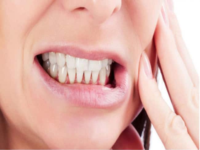 bruxism