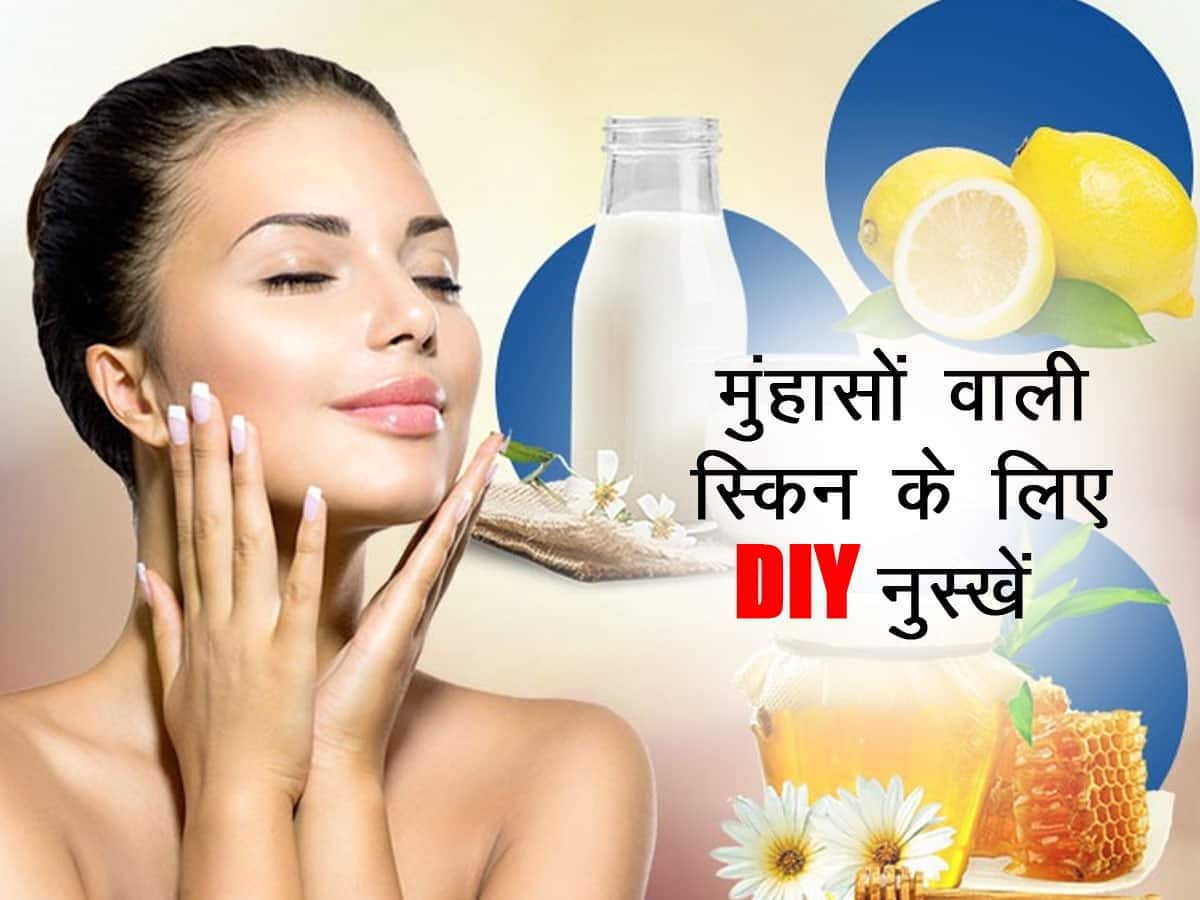 मुंहासों वाली स्किन के लिए 3 बेस्ट क्लींजर, जानें इन्हें घर में बनाने का तरीका और इनके फायदे