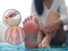 गाउट (Gout)