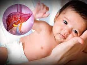 Mysterious Hepatitis Detected In Children Infected With COVID In MP
