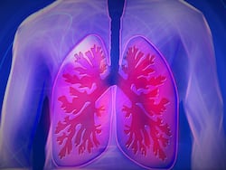 Breathing Lessons For Your Lungs: A Doctor's Guide To Keeping Lung Diseases At Bay