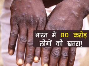 Monkeypox symptoms : भारत में फिलहाल मंकीपॉक्स नहीं लेकिन 80 करोड़ लोगों को खतरा, वजह जान उड़ जाएंगे होश