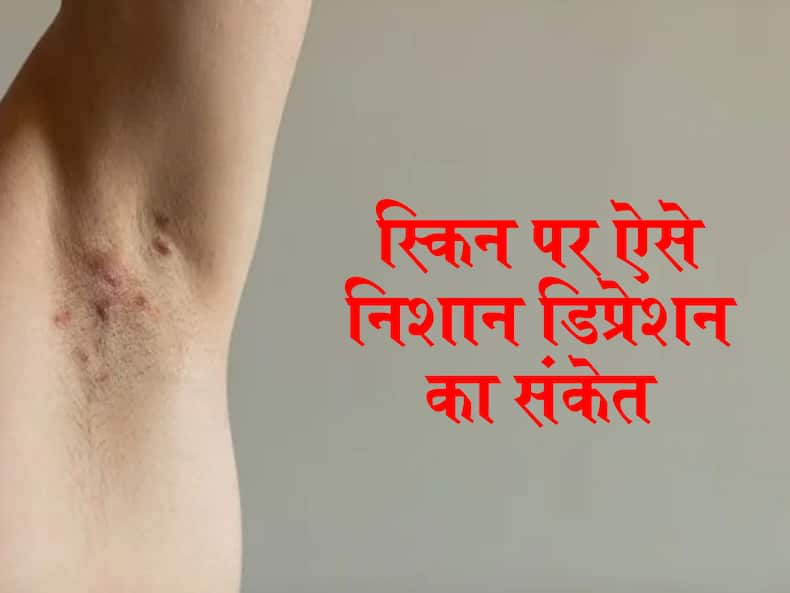 स्किन पर ये 4 तरह के बदलाव देते हैं इन 2 मानसिक बीमारियों का संकेत, प्राइवेट पार्ट की स्किन पर होता है ऐसा