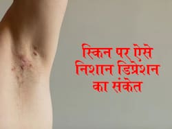 स्किन पर ये 4 तरह के बदलाव देते हैं इन 2 मानसिक बीमारियों का संकेत, प्राइवेट पार्ट की स्किन पर होता है ऐसा