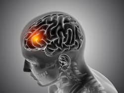 Beware Of The Rising Tide Of Stroke In India: Know If You Are At Risk