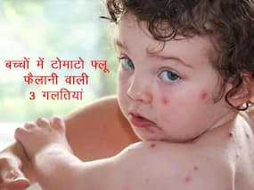 आपकी इन 3 गलतियों की वजह से आपके बच्चे को हो सकता है Tomato Fever! ज्यादातर लोग करते हैं ये गलतियां