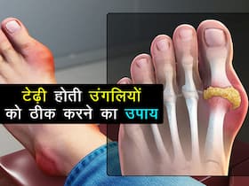 टेढ़ी-मेढ़ी दिखती हैं हाथ-पैर की उंगलियां तो शरीर में बढ़ गया है ये एसिड! इन 3 नुस्खों से पाएं आराम