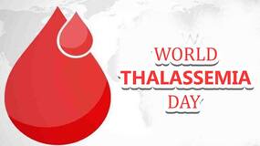 World Thalassemia Day 2022: क्या थैलेसिमिया का स्थायी इलाज संभव है? डॉक्टर ने बताया इस बीमारी में कितनी कारगर है स्टेम सेल्स थेरेपी