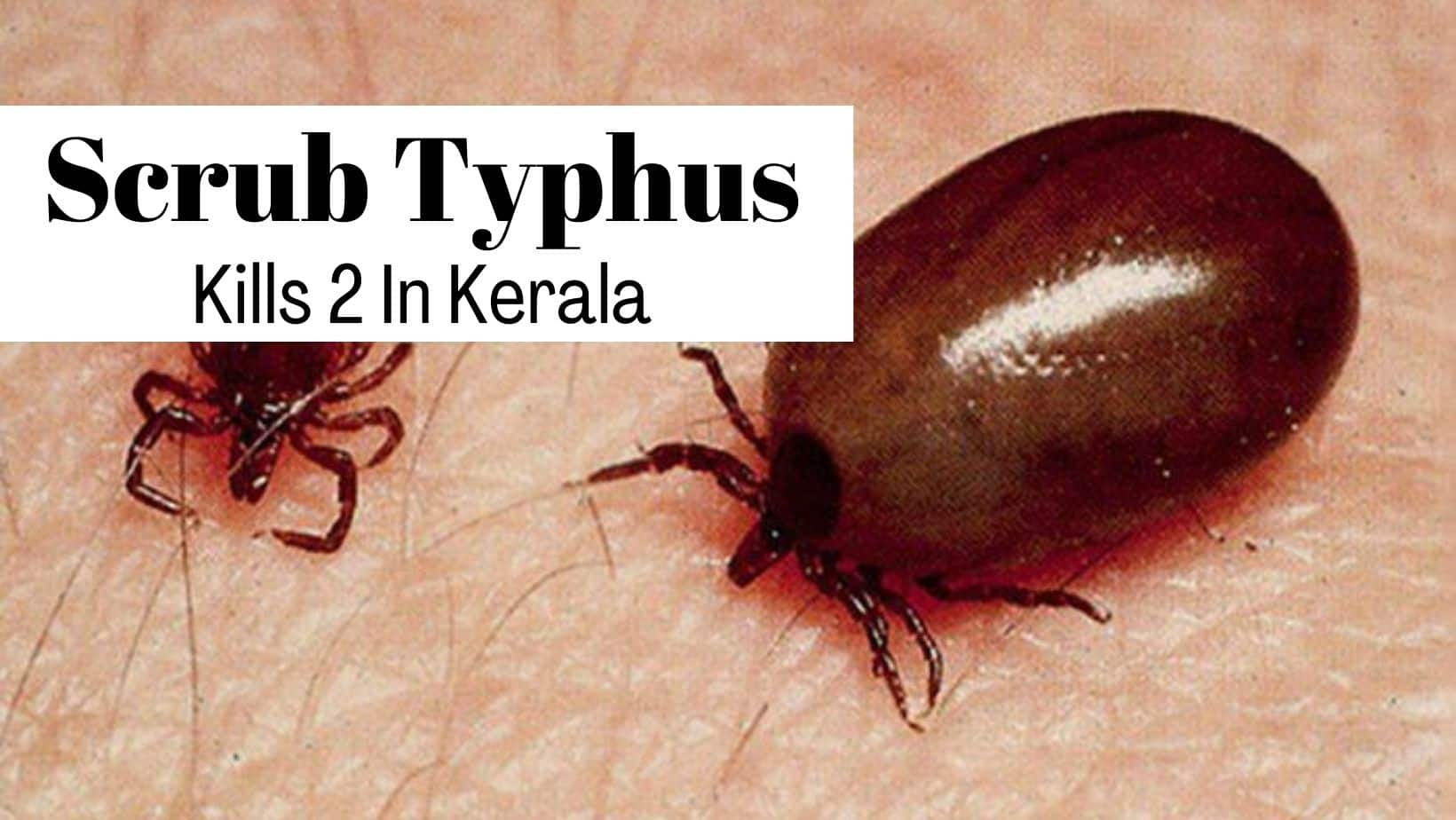 kerala-woman-dies-due-to-scrub-typhus-disease-fever-body-ache-and