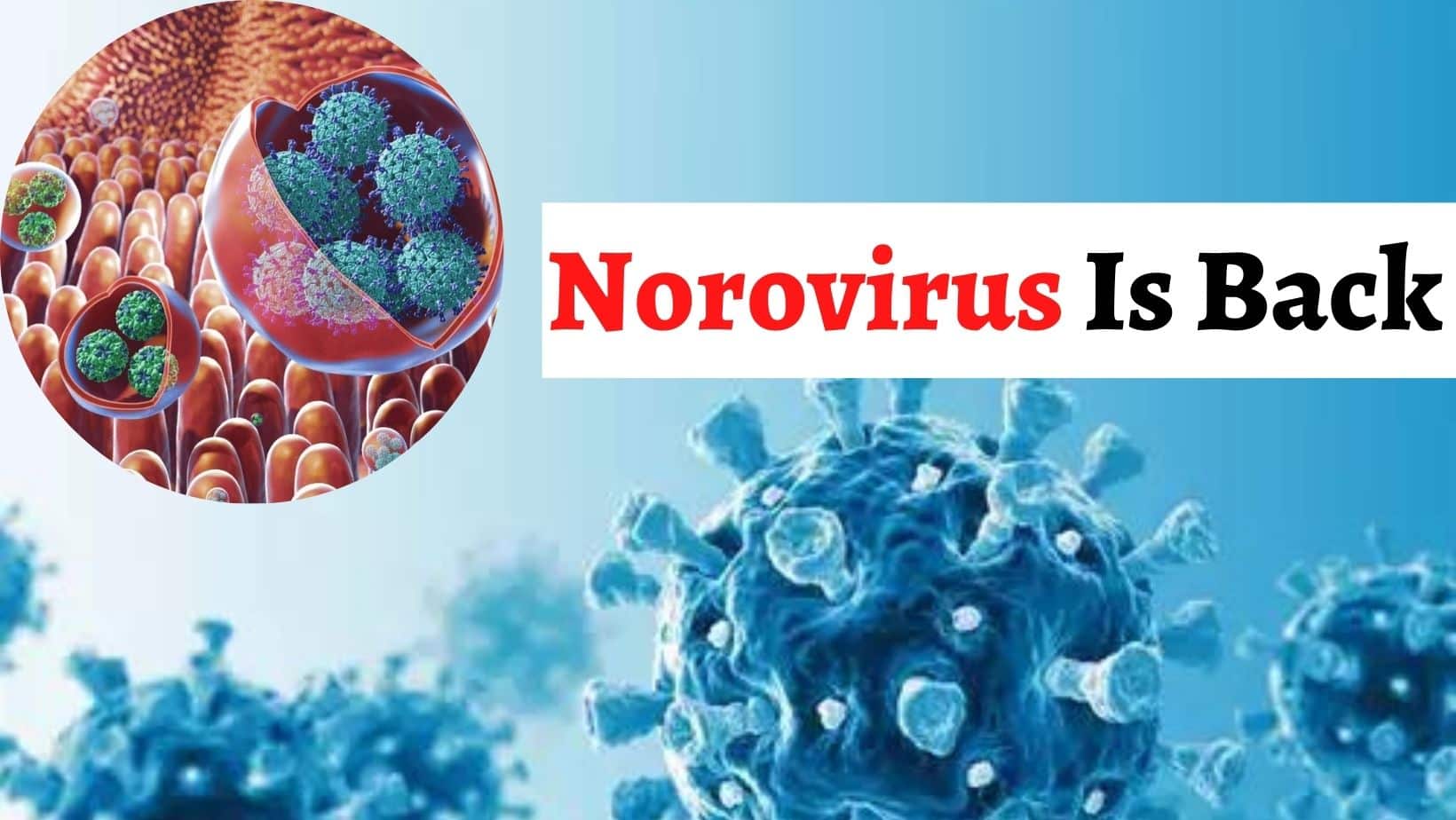 Norovirus Returns In India Two Primary School Students Found Infected