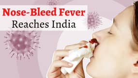 Rare Nose-Bleed Fever Enters India: 55-Year-Old Gujarat Woman Dies of Complications, 1 More Tests Positive