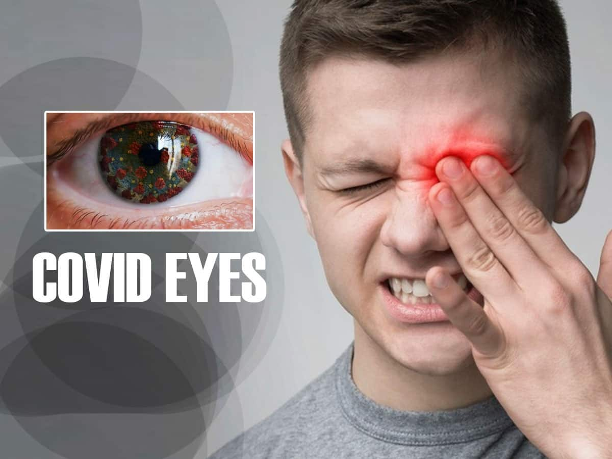 covid-eyes-sore-eyes-and-other-symptoms-your-eyes-may-show-after