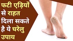 Cracked Heels: फटी एड़ियों से राहत दिला सकते हैं यह घरेलु उपाय, Watch Video