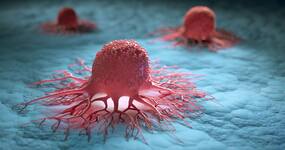Its A Miracle! Cancer Vanishes For Every Patient In Drug Trial, Indian Patients Among Those Healed Completely