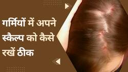 Hair Problems: स्कैल्प से निकल रही है पपड़ी या हो रहे हैं दानें, ऐसे करें इन्हें ठीक, Watch Video