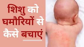 Summer Problems: बच्चों को घमौरियां होने के कारण, इलाज और घरेलू उपाय जानिए, Watch Video