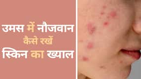 Skin Care Tips: यह उपाय युवाओं की स्किन को बनता है चमकदार और हेल्दी, Watch Video