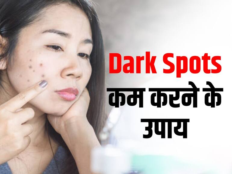 Diet For Blemishes Free Skin: चेहरे पर डार्क स्पॉट्स से हैं परेशान तो इस तरह की डाइट लेना करें स्टार्ट, स्किन बनेगी हेल्दी और स्पॉटलेस