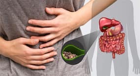 Gallbladder Stones: 5 Foods To Avoid After Operation