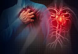 Can Stress Cause a Heart Attack? Here's What Science Says