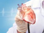 Pericarditis