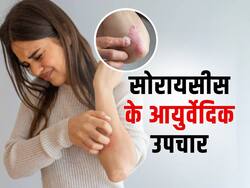 त्वचा पर लाल पैचेस और खुजली हो सकते हैं सोरायसीस के लक्षण, जानें इस बीमारी के आयुर्वेदिक उपचार
