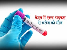 केरल में स्क्रब टाइफस से दूसरी मौत, जानें कैसे फैलती है यह बीमारी और क्या हैं इसके लक्षण और कारण केरल में स्क्रब टाइफस से दूसरी मौत, जानें कैसे फैलती है यह बीमारी और क्या हैं इसके लक्षण और कारण