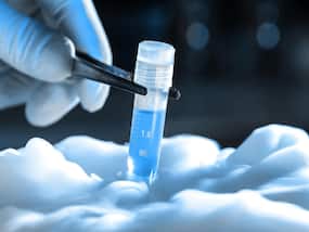 Father   s Day: Sperm Cryopreservation Can Help Men With Cancer To Fulfill Their Fatherhood Dream