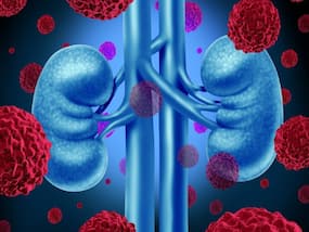 COVID-19 Complications Can Cause Kidney Damage, Warns Doctor