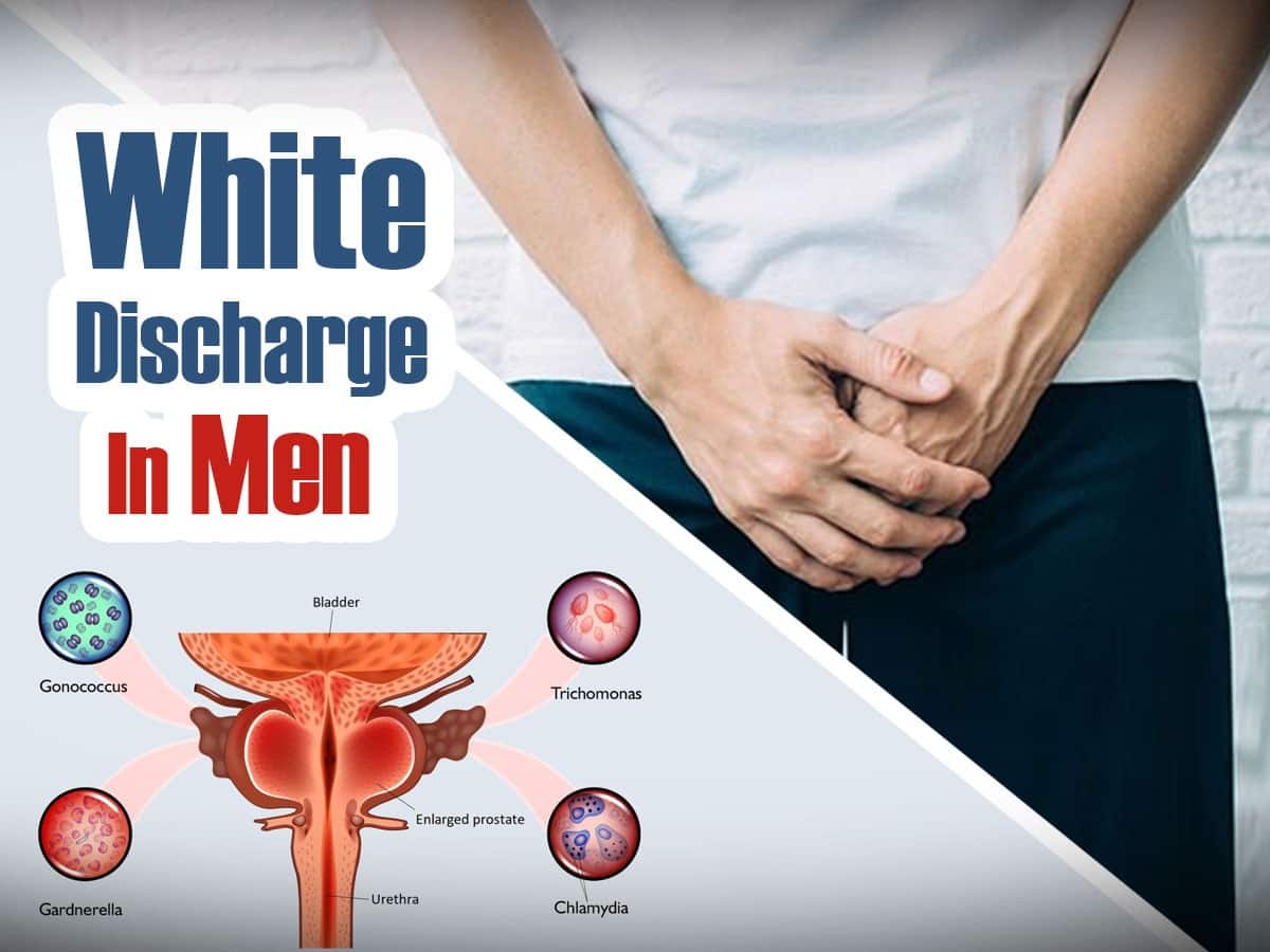 White Discharge In Men: What Causes Unusual Penis Discharge