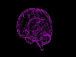 Brain Tumors Formation