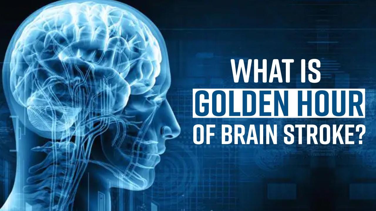Brain Stroke Know about Golden Hour During Brain Stroke, Watch Video