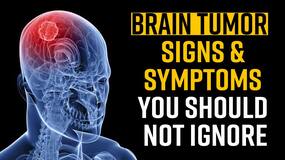 Brain Tumor Day: Symptoms, Causes and Treatment- Watch Video