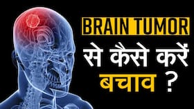 Brain Tumor Day: क्या होता है ब्रेन ट्यूमर, जाने इसके लक्षण और इसका इलाज डॉक्टर से, Watch Video