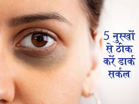 डार्क सर्कल ने बिगाड़ दी चेहरे की खूबसूरती? घर में 20 मिनट करें ये 5 काम और नार्मल करें स्किन का रंग